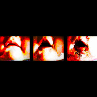 © Pier Paulo Zimmermann