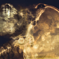 Røntgenbillede af Jeppe Ernst. © Niklas Ottander